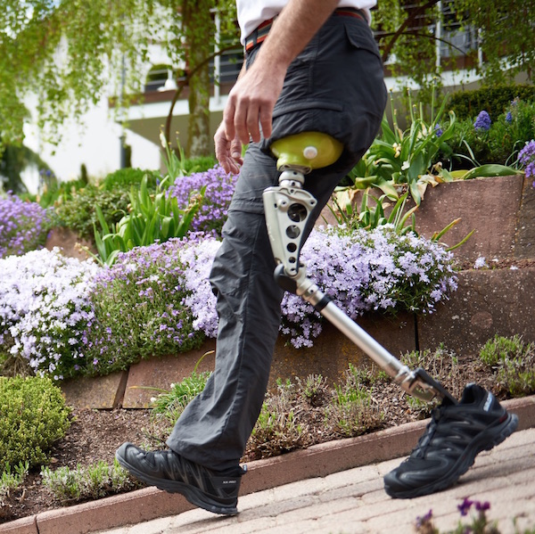 Prosthetic Knee For Short Stump — Amputee Prosthetic Leg Tips