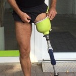 Amputee putting on above knee prosthetic leg.